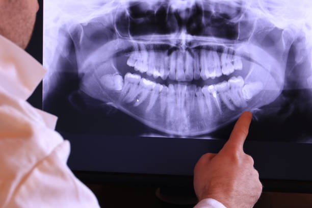 Emergency Dental Filling Replacement in AR